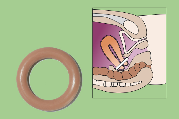 Büttner Frank wuerfel Büttner Frank ring