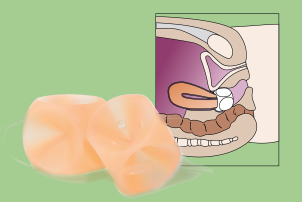 Büttner Frank wuerfel Büttner Frank wuerfel